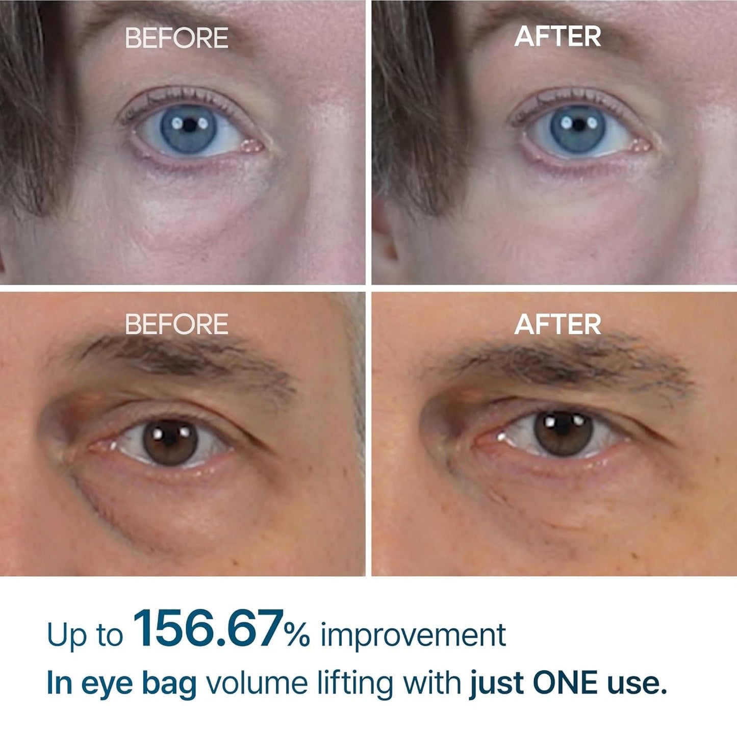 Eyephalt Miracle Repair Cream – EGF-Infused Under Eye Savior (0.33 Fl.Oz)